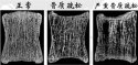 超声91视频下载免费仪厂家为您介绍缺钙骨质疏松症