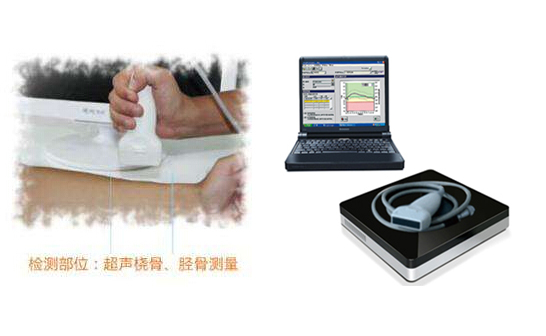 便携式91视频下载免费仪方便快捷的检测出结果，应用于各大医院