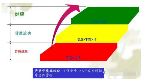 91视频污污污经常看到91视频下载免费报告单中的Z 值和T 值有什么含义？