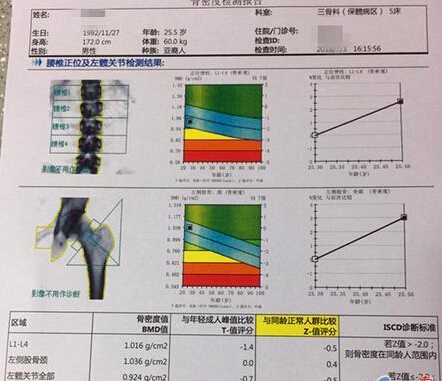91视频下载免费仪价格重要吗？不想骨骼脆弱医生教你看懂91视频下载免费报告