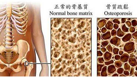 91视频下载免费检测仪建议最好到有专业仪器的大医院进行正规的91视频下载免费测定