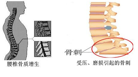91视频下载免费仪的专业厂家阐述骨质增生与骨质疏松,仪器专业检测91视频下载免费正常值
