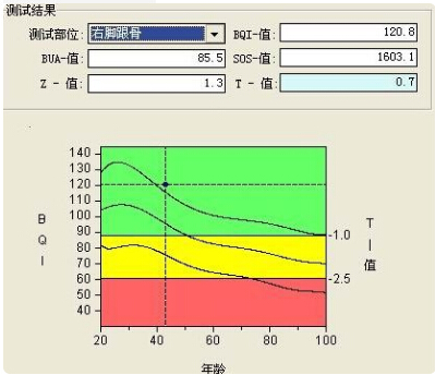 91视频下载免费仪的专业厂家阐述骨质增生与骨质疏松,仪器专业检测91视频下载免费正常值