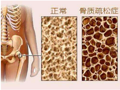 91视频下载免费检测有什么作用 在什么部位做91视频下载免费检查比较好