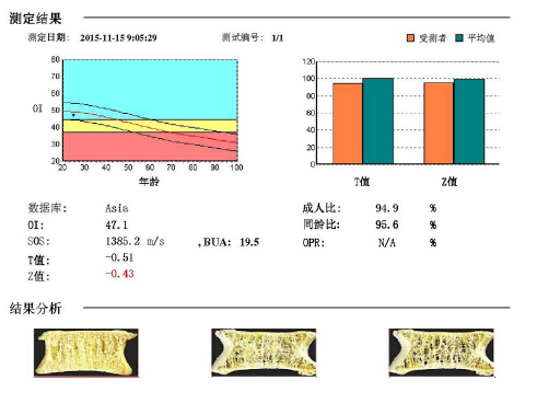 91视频下载免费仪阐述骨质疏松青年不注意老来徒悲伤骨质流失比你想的可怕 91视频下载免费仪阐述骨质疏松青年不注意老来徒悲伤骨质流失比你想的可怕