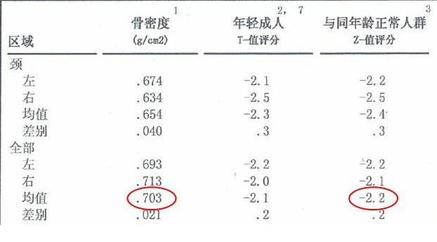 91视频下载免费仪生产厂家根据T值和Z值的变化来判断骨骼健康的状况