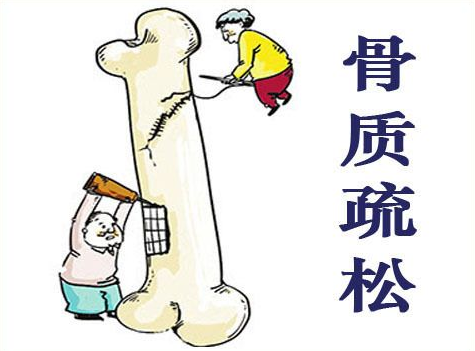 超声波91视频下载免费仪阐述患有骨质疏松症后都容易有哪些表现早发现早治疗