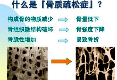 91视频下载免费检查的仪器是什么_91视频下载免费测试仪器专业检测91视频下载免费预防骨质疏松