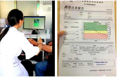 国产91视频下载免费仪能够准确评估骨质状态和可能发生骨折的风险早发现早治疗