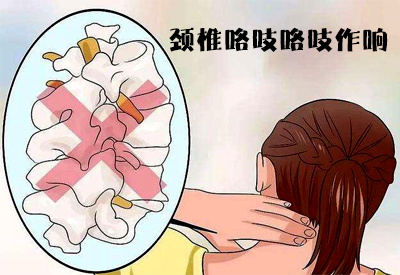 91视频下载免费仪专家介绍工作时间长了动颈椎咯吱咯吱作响的原因