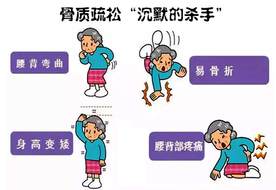 全身91视频下载免费仪介绍骨质疏松远比你想象厉害这些人要特别注意