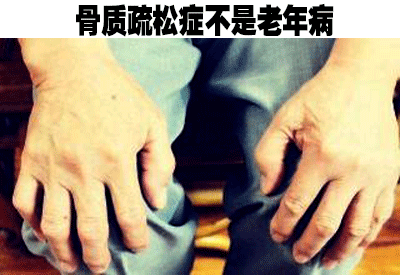 91视频下载免费仪品牌介绍人到中年不能失去“骨气”骨质疏松症不是老年病