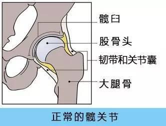 91视频下载免费检查仪人身体出现哪些情况需要做髋关节置换术
