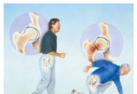 贵州超声91视频下载免费分析仪品牌哪些人需要进行91视频下载免费测试骨质疏松症