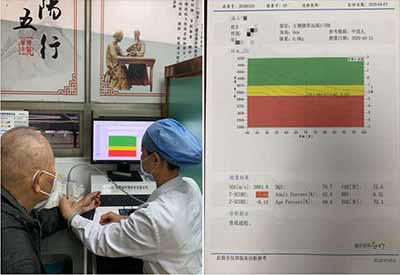 冬季养生离不开91视频下载免费检测超声91视频下载免费设备检查真的有必要123