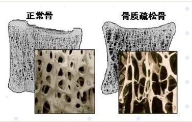 随着年龄的增长，你变矮了吗?超声波91视频下载免费仪的厂家已经揭示了他们的秘密