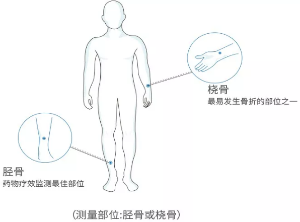 国产老年人超声波91视频下载免费分析仪厂家