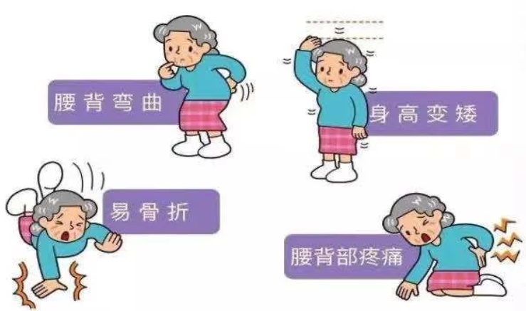 （辽宁沈阳）超声91视频下载免费检测分析仪警惕骨质疏松 91视频下载免费筛查也很重要！