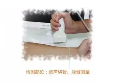 手提式超声儿童91视频下载免费仪mqd-7000品牌测桡胫骨部位原理及适用范围